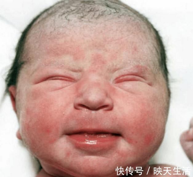 颜值|宝宝出生后,这3个地方越丑,长大后颜值越高!家长就偷着乐吧