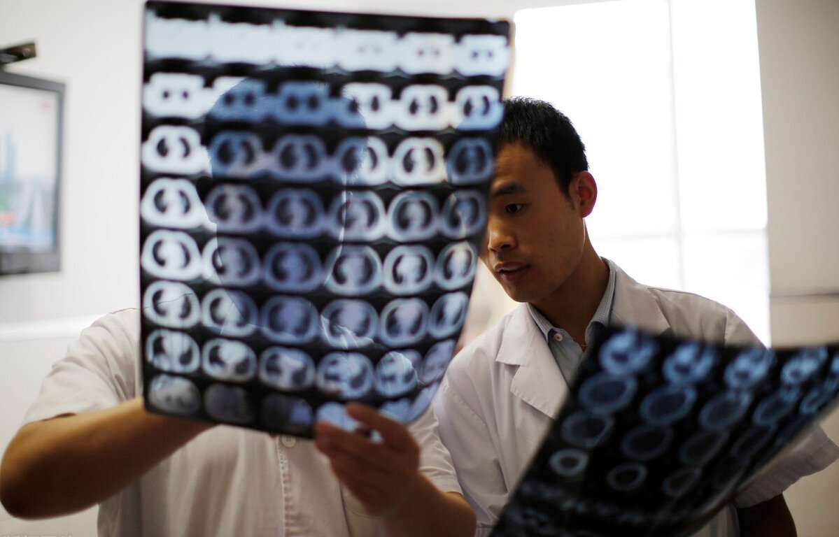 海马|9岁孩子查出“健忘症”,医生叹息:2类食物哪能天天吃,平时少买