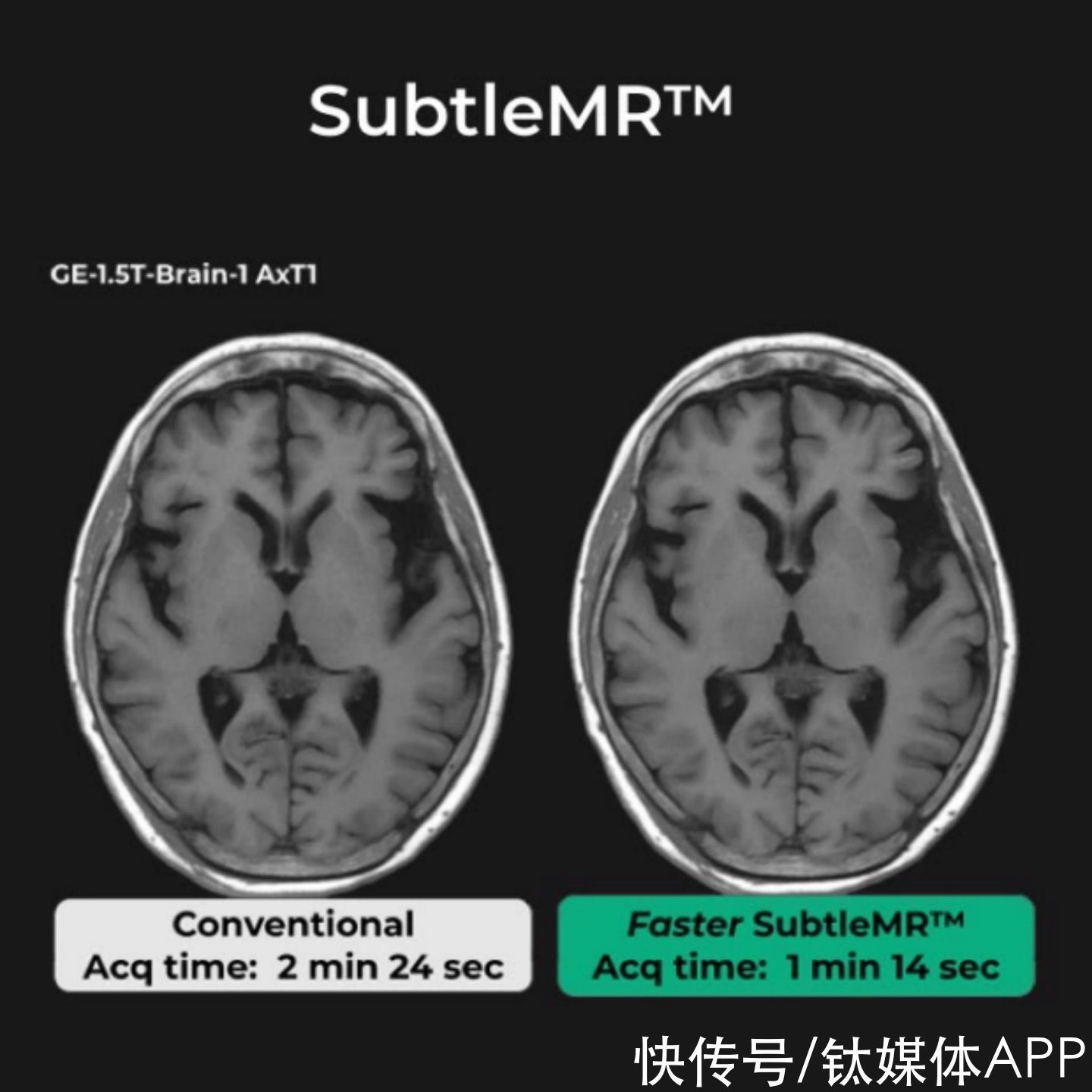 医学进入“读图时代”,AI如何助力快速成像?丨快公司