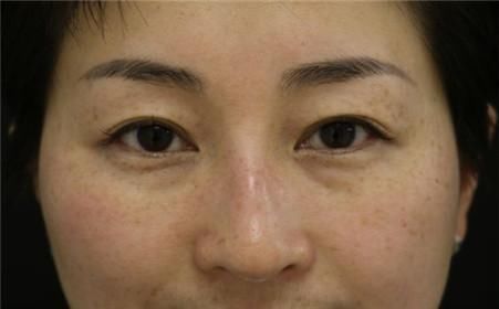 脸上暗沉长斑的人，晚上别用清水洗脸，教你这样做，皮肤白嫩透亮