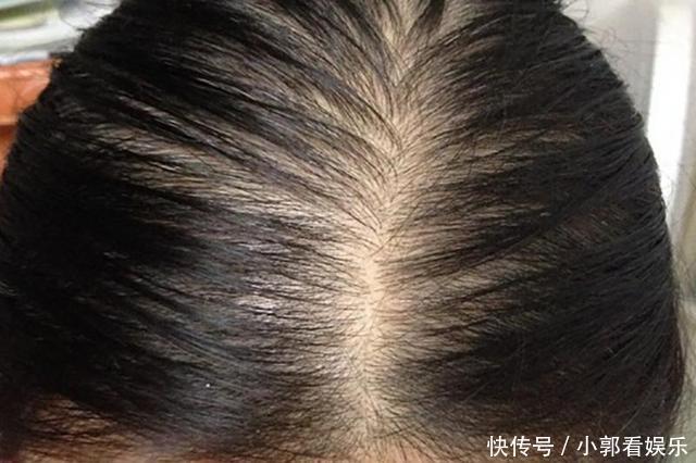 潘婷|这款老牌洗发水“重出江湖”打败潘婷欧莱雅,让海飞丝措手不及!