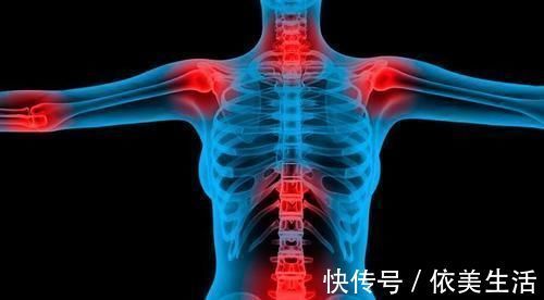 神经病变|其实这些疾病都属于糖尿病并发症,你知道几个?