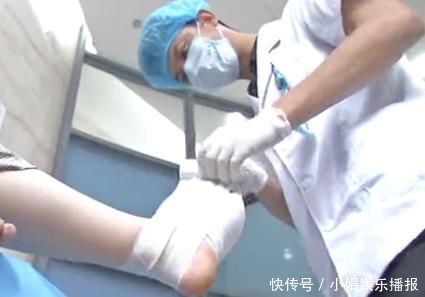 外翻|爱穿高跟鞋的女性一定要小心,拇指外翻堪比“裹脚”!不可忽视