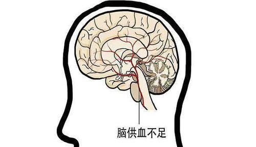  脑供血不足的“特效药”，每天吃一点，头不疼也不晕了，气血畅通