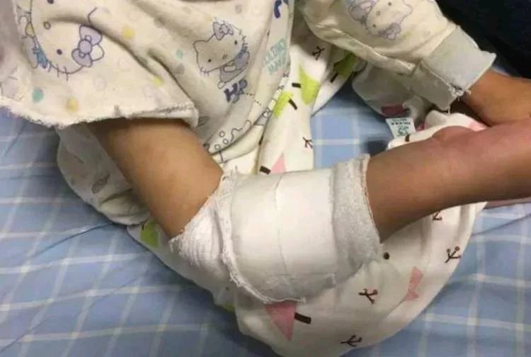 橡皮筋|4岁女孩得怪病,医生检查后,忍不住训斥父母心真大