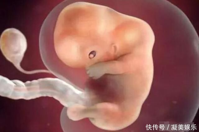 孕妇|十月怀胎,哪几周是胎儿畸形的高发期看完后明白了