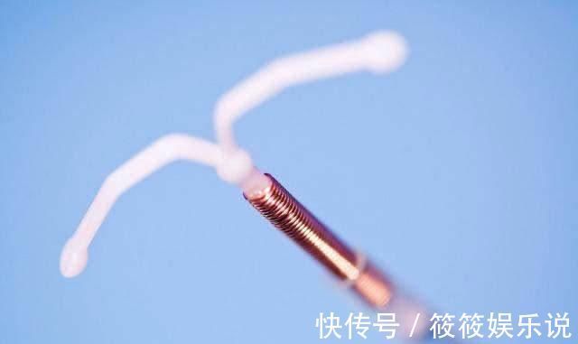 节育环|这4种避孕方式都不错,女性最好选择第3种,或许有利于身体健康