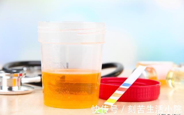 肝火旺盛|养肝“王中王”发现了！坚持吃它一周，赶走肝火口臭冲走！