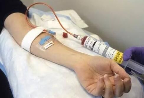 癌细胞|一旦确诊肿瘤,都必须进行化疗吗?多数人不知道,不妨瞅一眼吧!