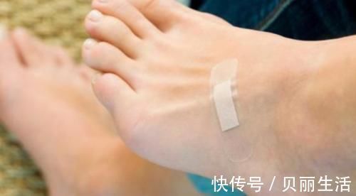 蒲公英|血糖偏高的人,脚上可能会有这3种表现,你可能不注意