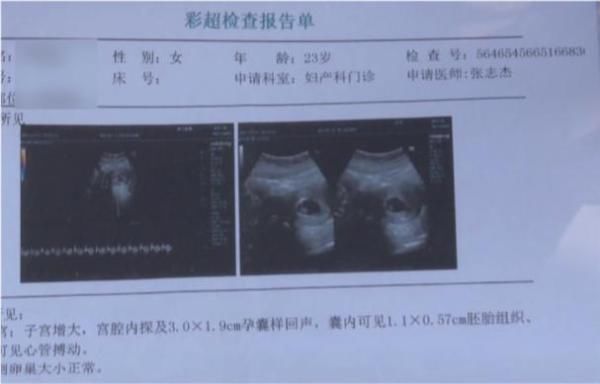 23岁姑娘全麻做整形，术后2天恶心反胃，一查呆住：怀孕了！