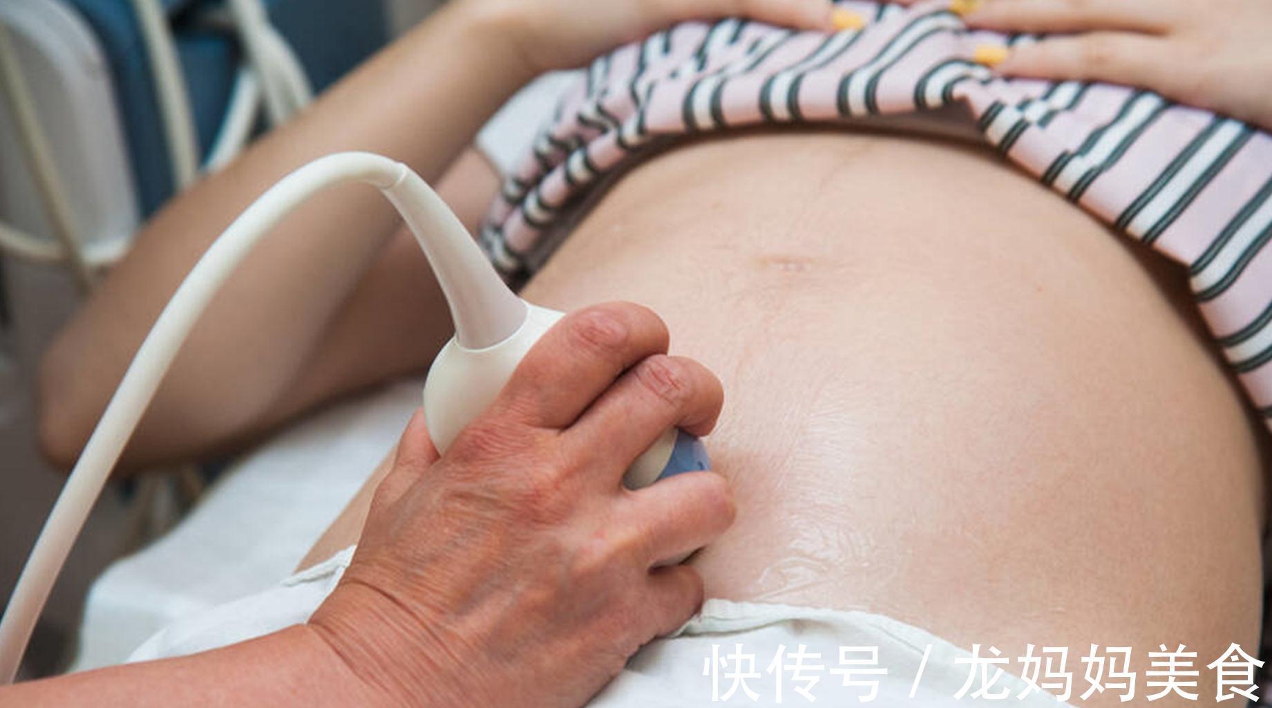 B超|B超、彩超、三维彩超、四维彩超,孕妇究竟该怎么选?一次性说清
