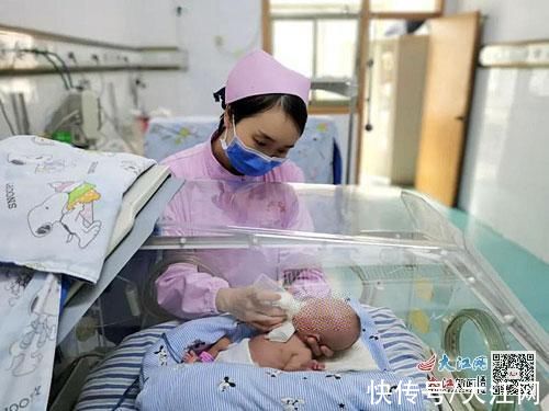 超早产儿|巴掌大的超早产儿奇迹存活