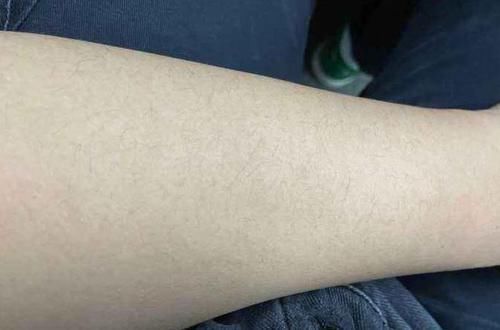 日常生活中|腿毛旺盛和没有腿毛的男人,两者有什么不同?医生说出了答案!