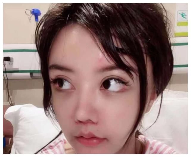 疤痕|韩安冉急于展示整容效果，蓬头垢面疤痕明显，为博关注下了手术就拍视频