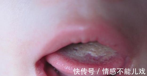 脾胃不好|孩子脾胃不好,不长个?谨记这“2事”,促进发育,身高棒棒的