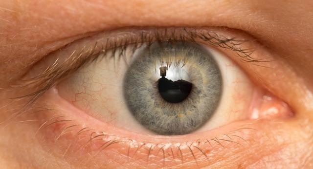 高脂血症|自然界四种天然''降脂药'',就在身边,常吃养护血管,血脂平稳下降