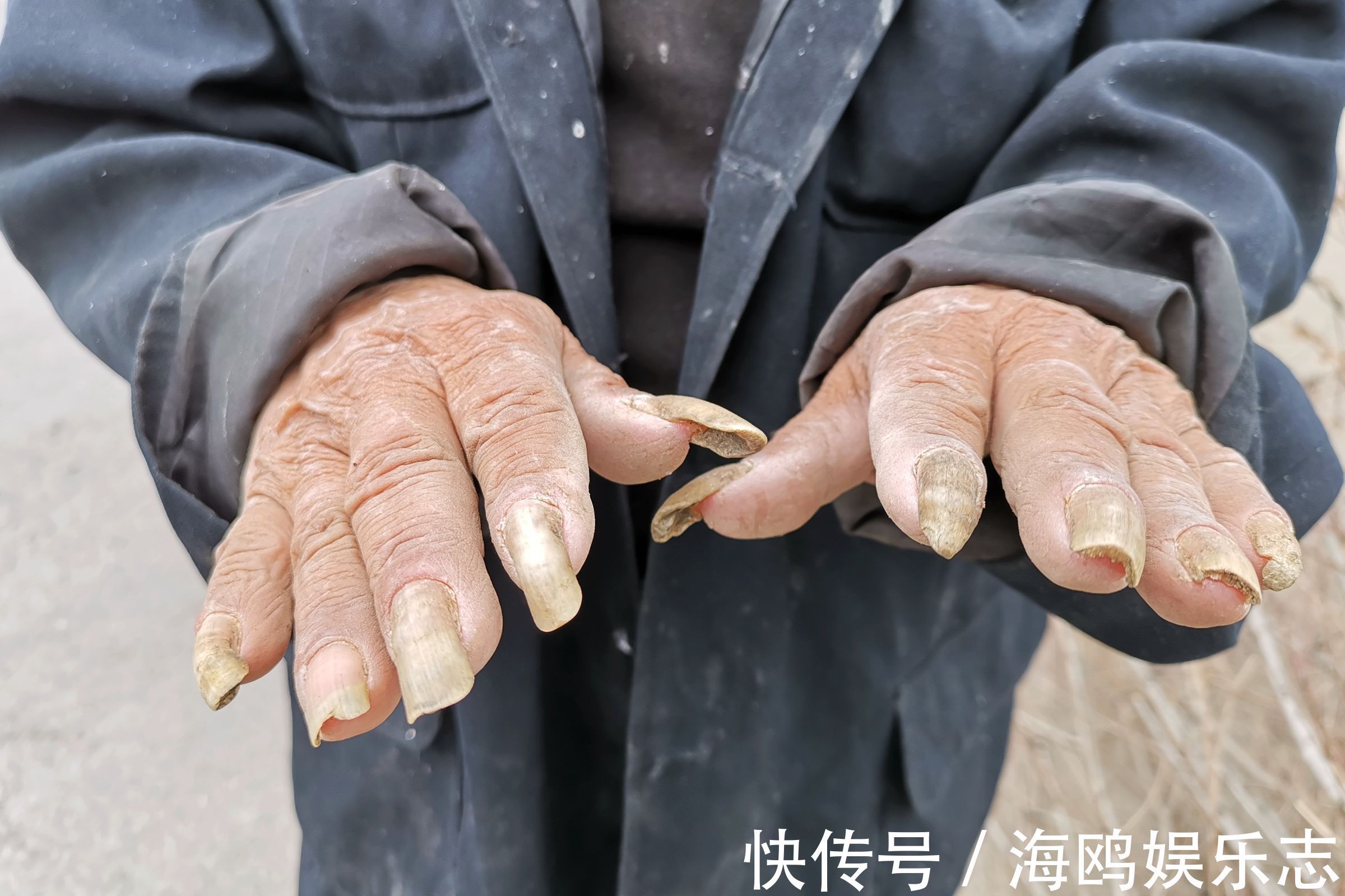 手指甲|农村7旬老人独身生活20年,手指甲长的惊人,看他生活成啥样
