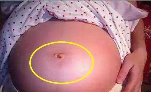 孕晚期|孕妈肚脐凸比凹好？别自己吓自己，区别倒是有，真相孕妈要了解