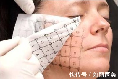 step 热玛吉价格一般是多少?千万别掉坑!