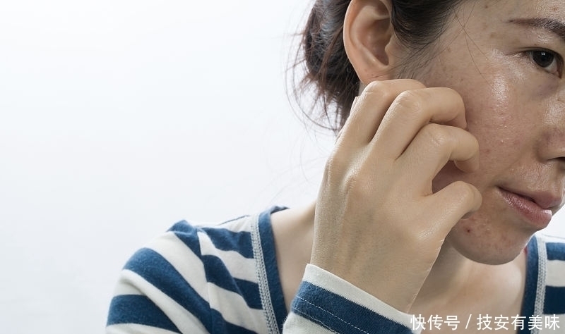 警示|警示:“螨虫脸”的人,3个感受很明显,说明螨虫在脸上爆发了!