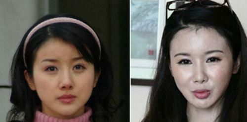 张檬后悔整容卖惨上热搜蹭热度,比张檬美十倍的她,也被整容害了