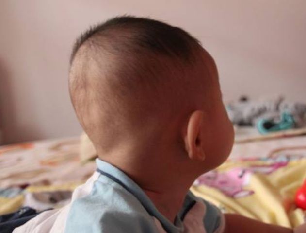 医生|宝宝多大就可以睡枕头了?看看医生怎么说,别再盲目给孩子用了