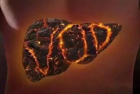 栀子|心火、胃火、肝火、肺火、肾火,一个4味药方,五脏之火通通扑掉