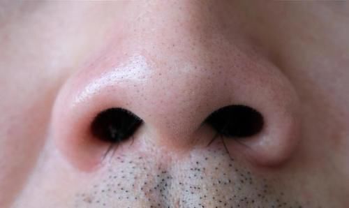 毛发|“鼻毛变白”是衰老前兆吗?其实还有其他可能,男性朋友多注意