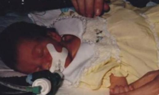 狒狒|36年前，美国医生将狒狒的心脏移植给一名婴儿，成功救助后来如何