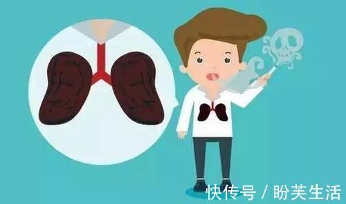 戒烟|肺癌的10大早期症状!早发现,九成可治好