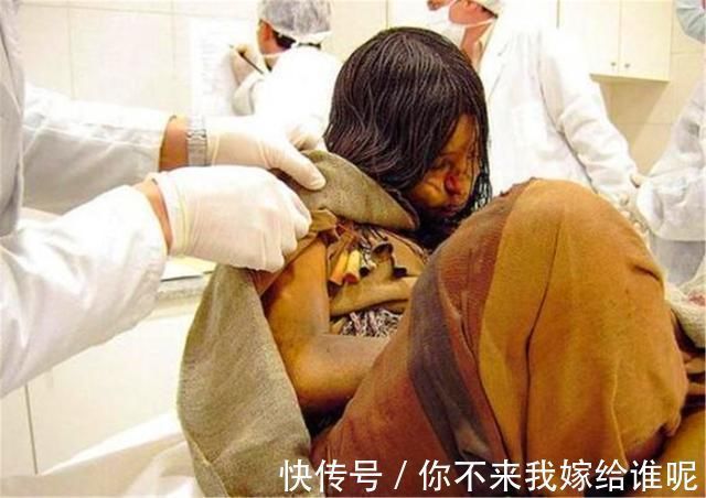 尸体!山顶现16岁少女尸体,距今550年依然完好无损,X光结果令人意外!