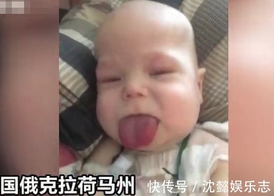 巨舌|在B超检查时,妈妈看到孩子扮鬼脸还觉得可爱,出生后却吓一跳