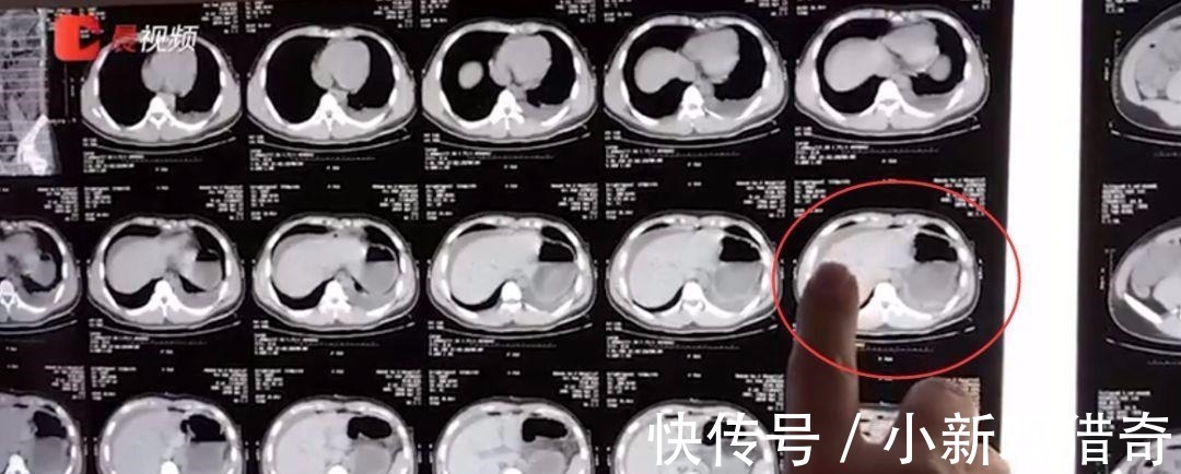 訓練|堅持鍛煉3個月后, 我殘廢了!