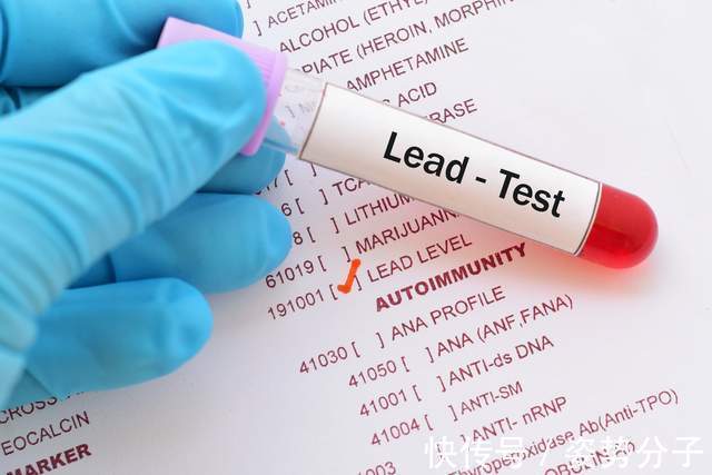 金山医院|8亿儿童可能铅中毒,你还不提高警惕吗?哪些物品可能含铅?