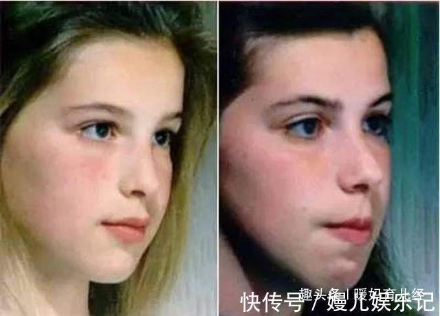 饮食量|以下3种孩子“越长大越丑”,无论现在多漂亮,父母最好都要留意