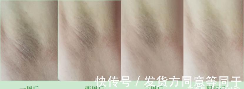 拆君|评测 ｜ 历时30天，真人实测娜蜜丝冰钻6.5高能量光子脱毛仪