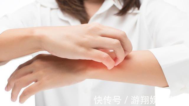 苦瓜|身体若2处“发痒”,或是在暗示你体内血糖已经“超标”了