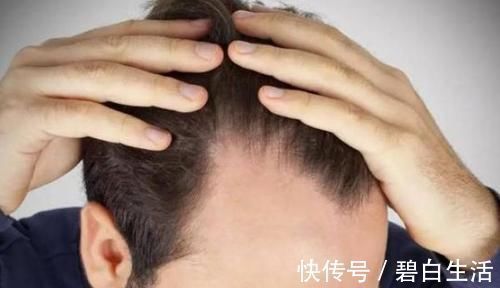 洗头|用盐水洗头有奇效？盐不仅是调味品那么简单，看完快告诉家人