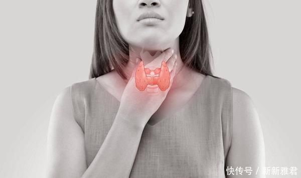 癌变|甲状腺结节最终诱发癌变?医生提醒:日常注意3点,预防恶变