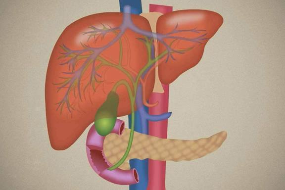 肝脏|90后夫妻，同时查出肝硬化，医生这2物吃天天吃，肝遭不住