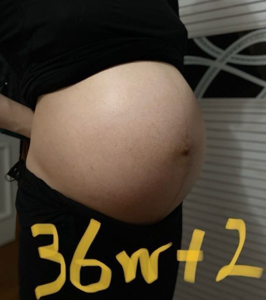 信号|“肚子总是硬硬的,是什么原因”孕妈妈应该窃喜