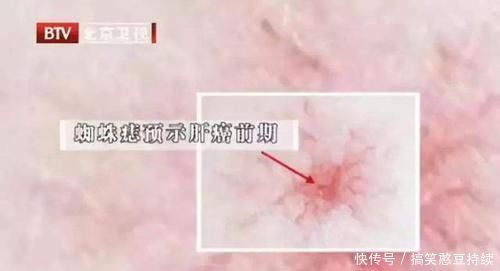 中年|“养肝高手”找到了,不是胡萝卜,每天泡水喝两杯,给肝脏洗洗澡