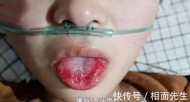 感冒药|恶毒至极!18岁女孩“遭姐夫”下毒:将“百草枯”掺进感冒药中!