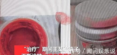 男童|父母嫌医药费贵求助江湖医生,用秘方给幼童治烫伤致其感染身亡