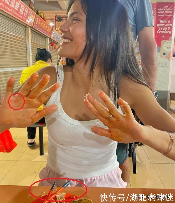 澳网|华裔美女澳网失利原因被曝光：右手反复起水泡，坚持用筷子吃饭