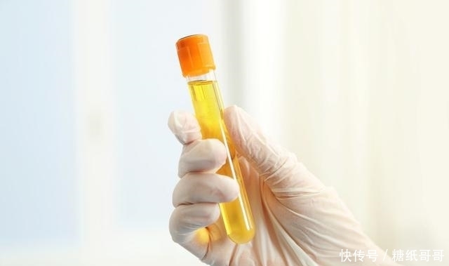  牛奶|尿酸高的人，多吃这5种食物，长期坚持，痛风不找！
