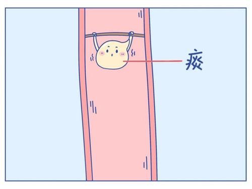 把痰咽回去，会不会对身体不好啊？