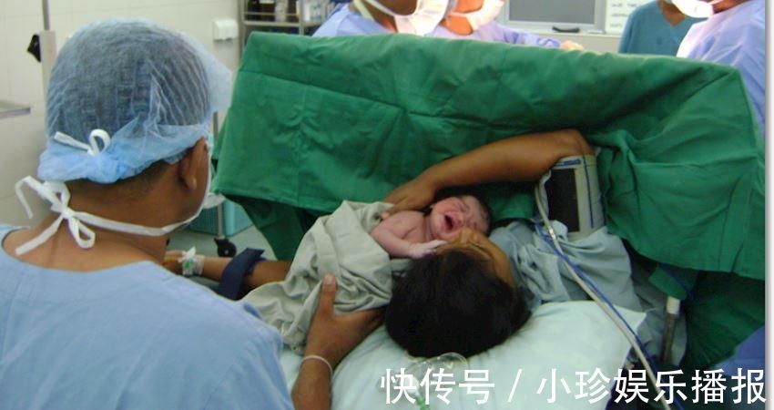 镇痛泵|剖腹产最痛的是什么?过来人分享下我的感受