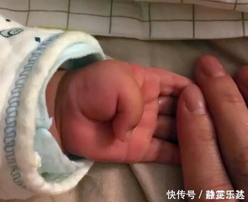 出生率|宝宝拇指内扣，大脑会很笨？超过这个月龄没好转，就该及时就医